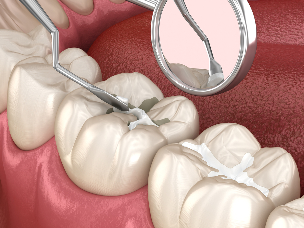خدمات Tooth Guard للأسنان